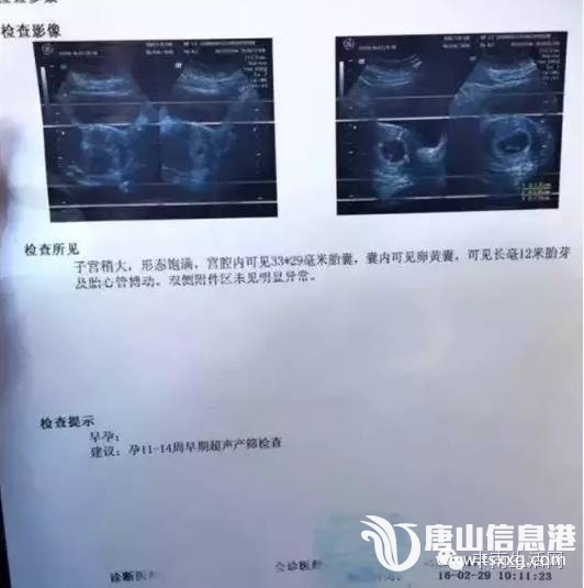 dce645c5f5cbd3e2e2be26f366f2d9d9.jpg