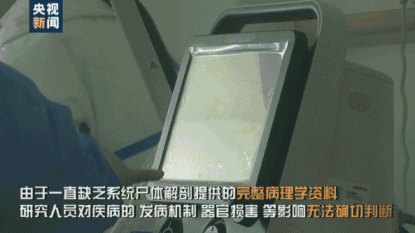 9ca7a6ef28d6f3caf9fdd17b1148ce58.gif
