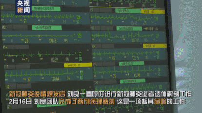 34331227f4689e2102b71b549b60865b.gif